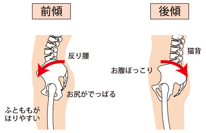骨盤の状態を把握することの重要性